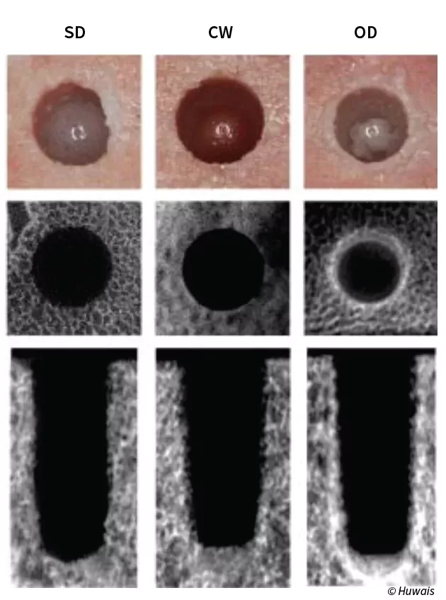 Comparing Osteotomies (from left to right): Standard Drilling (SD), Densah&reg; Bur Clockwise Cutting (CW), Densah&reg; Bur Counterclockwise Osseodensification (OD) 